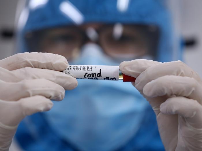  Cifras de muertes y contagios por covid vuelven a subir en Colombia