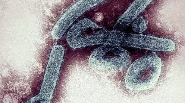  La preocupación por el primer brote en Ghana del mortal virus de Marburgo, de la misma familia que el ébola