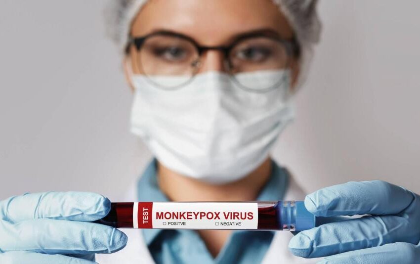  Viruela del mono: Colombia registra 55 casos de contagio