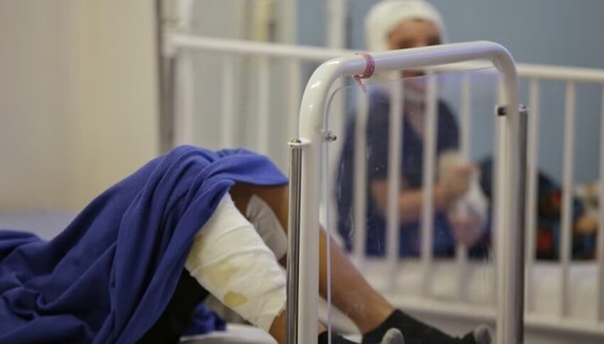  Asciende a 260 la cifra de personas quemadas con pólvora, según el Instituto Nacional de Salud